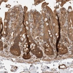 IRE1 alpha Antibody, Novus Biologicals:Antibodies:Primary Antibodies